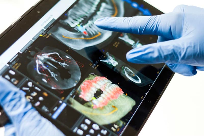 Planificación dental 3D en tablet
