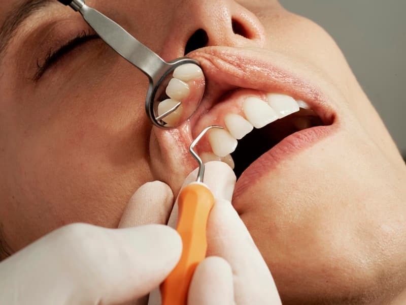 Examen dental