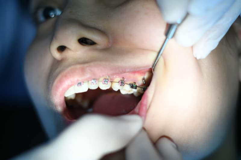 Tratamiento de ortodoncia